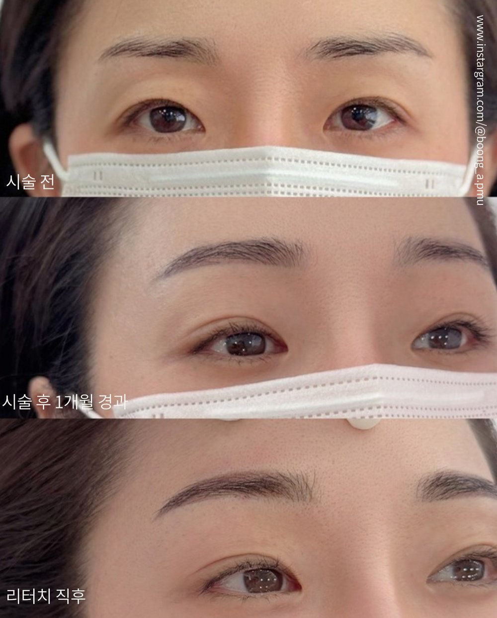 자연눈썹 시술 전후 비교 1